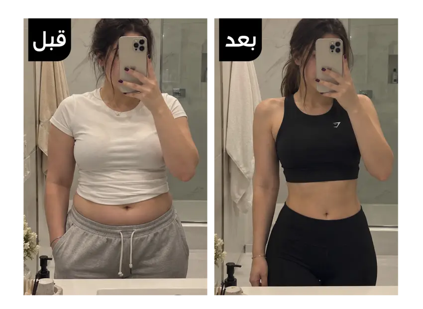 نتيجة قبل وبعد استخدام ترافيس جيل لنسف دهون البطن والأرداف 2